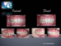 /album/casos-clinicos1/m-i-lamego-jpg2/